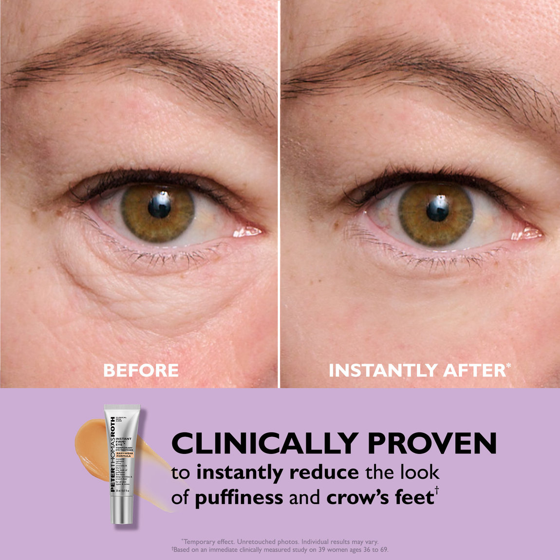 Instant Under Eye Bag Remover